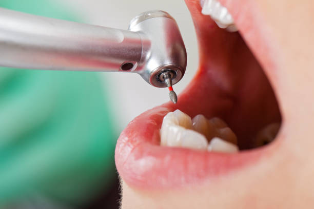 Best Mobile Emergency Dentist in Cleveland, OH